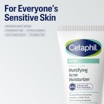 Vegan Mattifying Face Moisturizer for Acne-Prone Skin