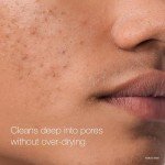 Vegan Acne Face Pads with Salicylic Acid, 60 Count