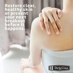 De La Cruz Vegan Sulfur Acne Treatment Ointment