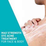 Vegan Acne Foaming Cleanser with Benzoyl Peroxide