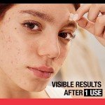 Vegan Acne Pimple Patches for Clear Skin