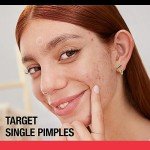 Vegan Acne Pimple Patches for Clear Skin