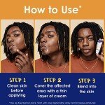 Vegan Acne Spot Treatment Cream - 5-in-1, 1 oz