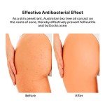 Vegan Butt Acne Treatment Cream with Salicylic Acid