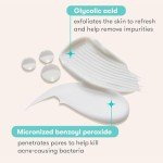 Vegan 3-Step Acne Treatment with Pimple Patches