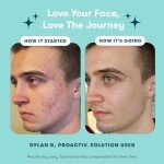 Vegan 3-Step Acne Treatment with Pimple Patches