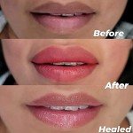 Double-Sided Silicone Lip Scrubbers – 2 Pack