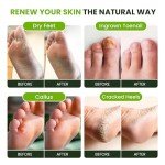 Vegan Tea Tree Oil Foot Soak for Healthy Feet