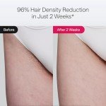 Ulike IPL Hair Removal Device for Home Use