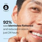 Vegan Acne Spot Dots - Hydrocolloid Pimple Patches