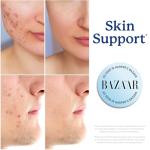 DIM Supplement 200 mg for Hormone Balance