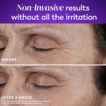 Vegan Retinol Night Cream for Smooth Skin