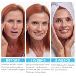 Vegan Retinol Cream with Hyaluronic Acid and Collagen