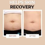 Roe Wellness Vegan Stretch Mark Cream for Moms