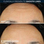 Vegan Anti-Aging Night Serum with Retinol Capsules