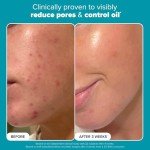 Paula's Choice Vegan BHA Exfoliant - Travel Size