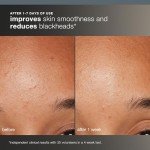 Daily Microfoliant Exfoliator with Salicylic Acid & Papaya
