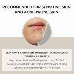 Madagascar Centella Asiatica Serum for Sensitive Skin
