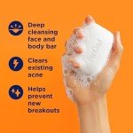 Vegan Acne Treatment Bar with 10% Benzoyl Peroxide