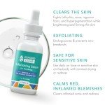 Level 2 Vegan Body Acne Clearing Serum