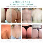 Level 2 Vegan Body Acne Clearing Serum