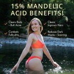 Level 2 Vegan Body Acne Clearing Serum