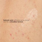 The Ordinary Vegan Salicylic Acid Body Serum 8.1 Fl Oz