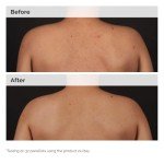 The Ordinary Vegan Salicylic Acid Body Serum 8.1 Fl Oz