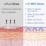 Urea Cream 40% & Salicylic Acid Foot Treatment