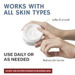 OUKEYA 40% Urea Cream for Dry Hands & Feet