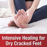 Vegan Foot Repair Ointment for Cracked Heels