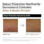 ANUA Rice 70 Glow Milky Toner - Vegan Skin Care