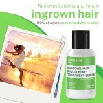 Tea Tree Gel for Ingrown Hairs & Bumps
