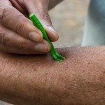 TickCheck Tick Remover Set for Pets & People