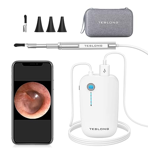 Teslong Otoscope iPhone, 4.3mm HD Inspection Camera, Ear Microscope, 6 Adjustable LED Lights with Ear Wax Removal Tools, Works with iPhone, iPad & Android