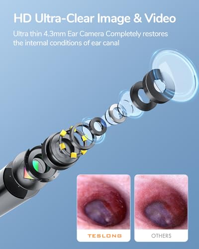 Teslong Otoscope iPhone, 4.3mm HD Inspection Camera, Ear Microscope, 6 Adjustable LED Lights with Ear Wax Removal Tools, Works with iPhone, iPad & Android
