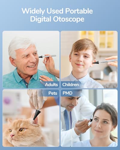 Teslong Otoscope iPhone, 4.3mm HD Inspection Camera, Ear Microscope, 6 Adjustable LED Lights with Ear Wax Removal Tools, Works with iPhone, iPad & Android