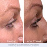 Obagi Nu-Cil Eyelash Enhancer Serum with Biotin