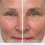 Obagi Nu-Cil Eyebrow Growth Serum with Hyaluronic Acid