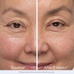 Obagi Eyelash & Eyebrow Enhancing Serum Set