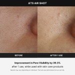 Medicube Age-R ATS Air Shot Microneedling Device