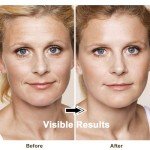 Lefay Anti-Aging Face Tightening Device