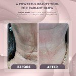 GLO24K Red Light Device for Face & Neck