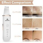 4-Mode Skin Scrubber Facial Spatula for Deep Cleansing