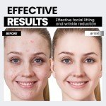 Smart Microcurrent Facial Device with Red Light Technology