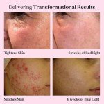 LED Face Mask Light Therapy Spa Kit (4 Pieces)