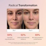 Solawave 4-in-1 Skincare Wand for Radiant Skin