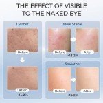 LED Face Mask for Skin Care & Light Therapy