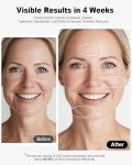 3-in-1 RF Skin Tightening Facial Device