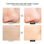 4-in-1 Face Spatula & Blackhead Remover Gadget